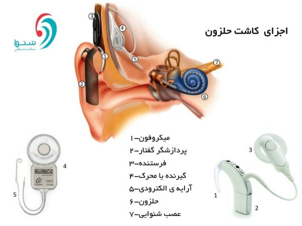 it is a implant-parts